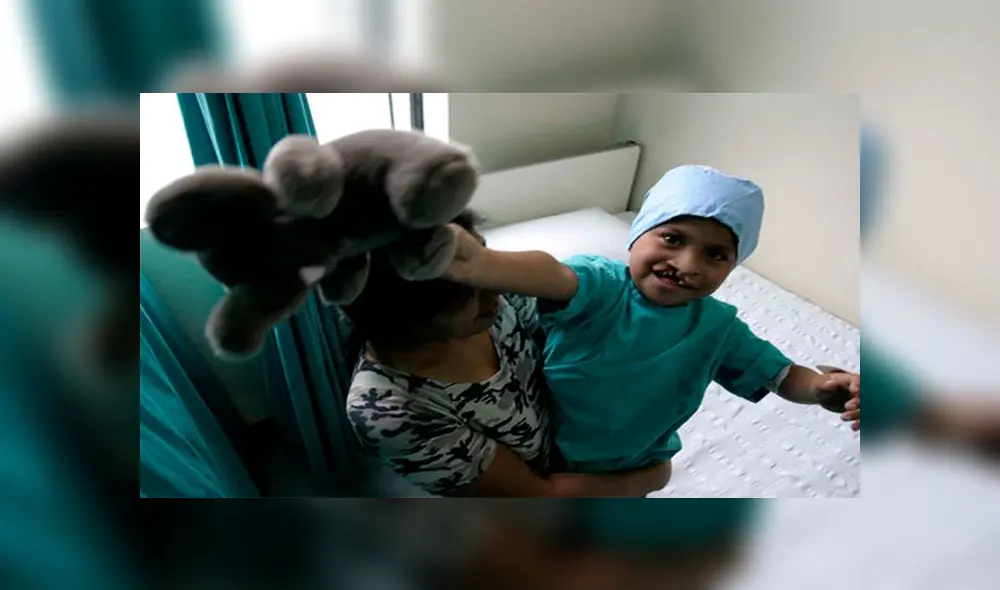 Más de 80 niños y adultos con labio leporino serán operados gratis en Cusco Más de 80 niños y adultos con labio leporino serán operados gratis en Cusco