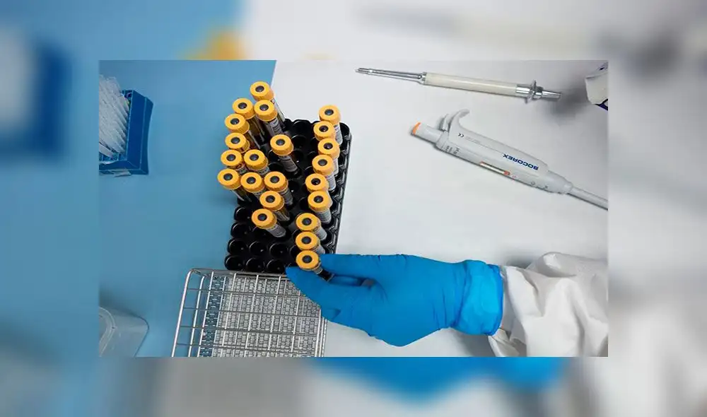 Un sinnúmero de estudios abocados al coronavirus se realizan en el mundo. Foto: EFE