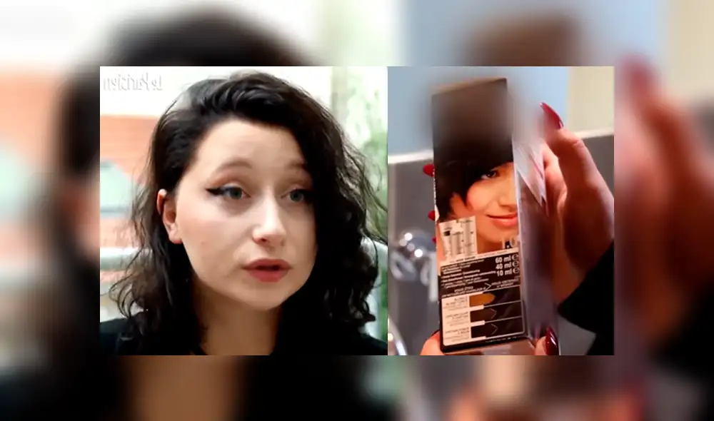 Facebook: chica acaba con la cara hinchada, porque se pintó el pelo y era alérgica al tinte [VIDEO]