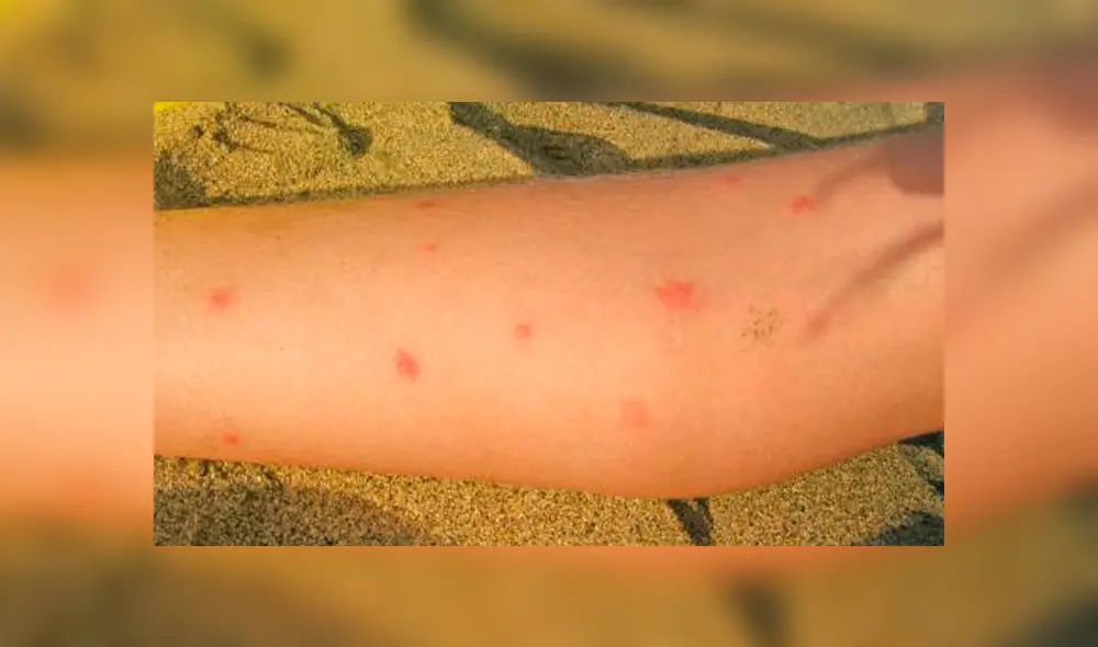 La Secretaría de Salud informó que los estados con mayor afectados son Guerrero de Jalisco, Veracruz, Yucatán, Tabasco y Quintana Roo. (FOTO: Internet) La Secretaría de Salud informó que los estados con mayor afectados son Guerrero de Jalisco, Veracruz, Yucatán, Tabasco y Quintana Roo. (FOTO: Internet)