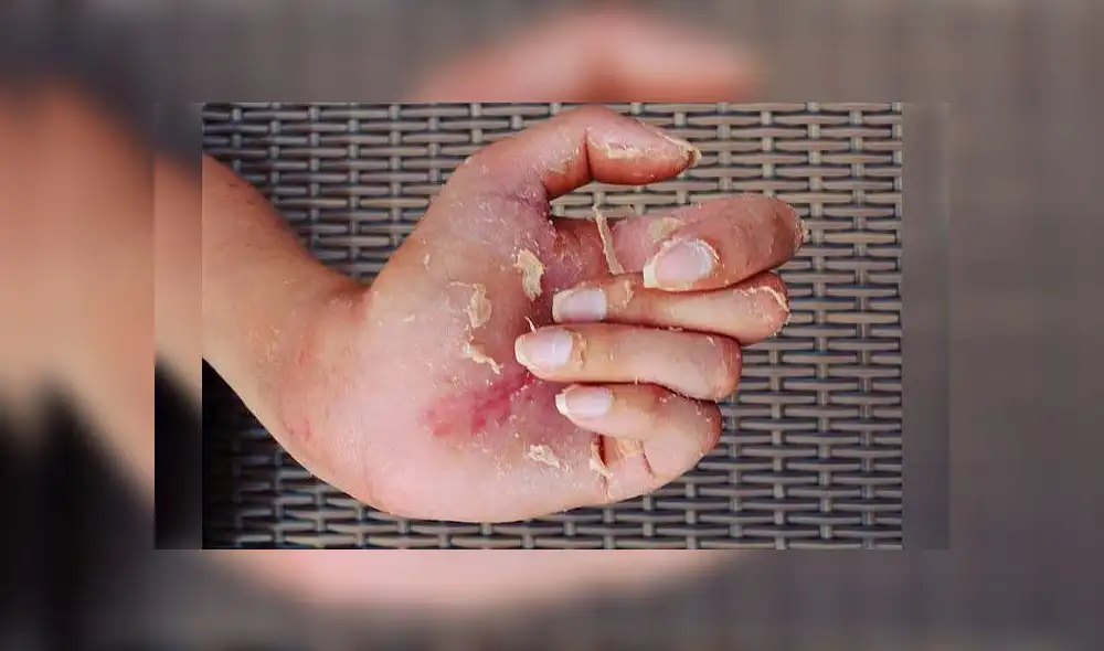 Mujer pierde el brazo luego de electrocutarse al tratar de enchufar su laptop Mujer pierde el brazo luego de electrocutarse al tratar de enchufar su laptop