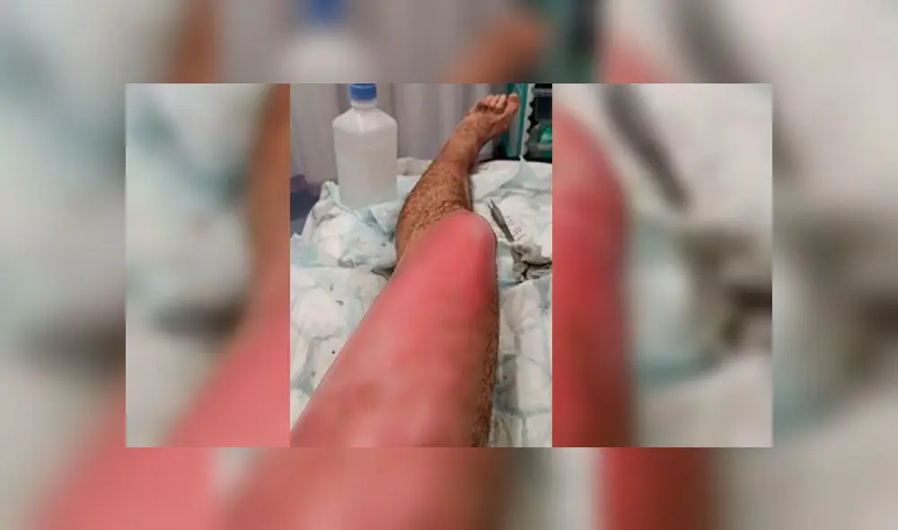 Cigarrillo electrónico Cigarrillo electrónico