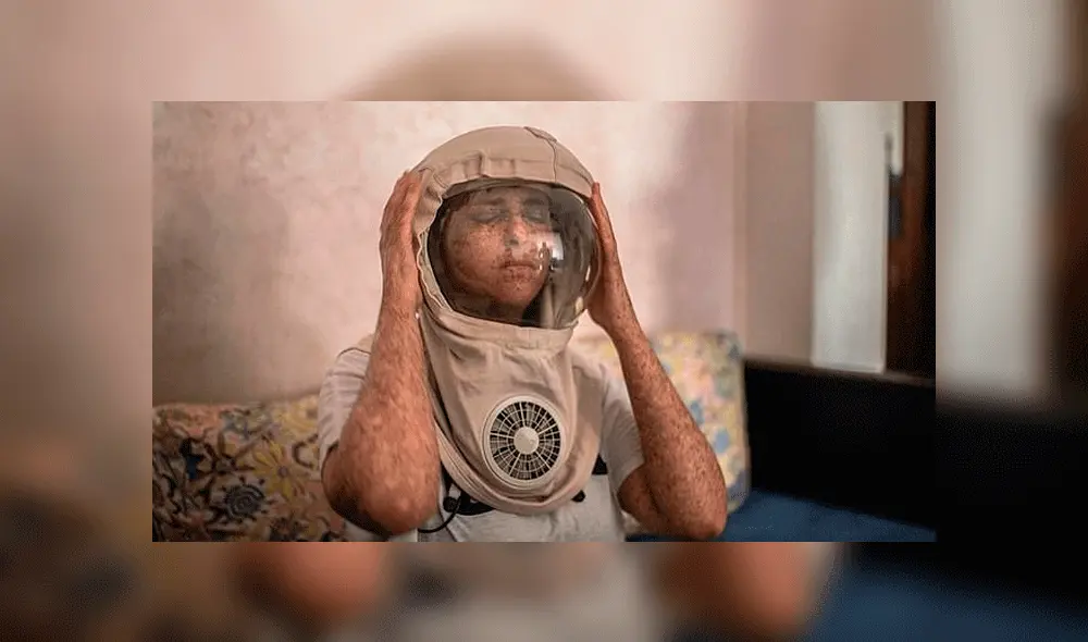 Fatima usa un casco que ella llama "de la NASA" para cuidarse de los rayos ultravioleta. Foto: MDWfeatures. Fatima usa un casco que ella llama "de la NASA" para cuidarse de los rayos ultravioleta. Foto: MDWfeatures.