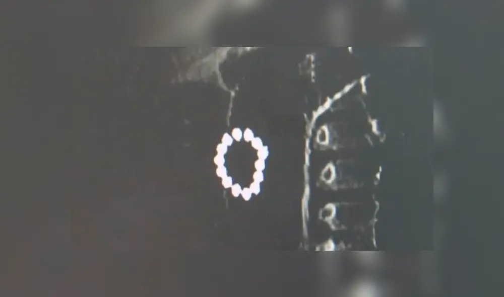 Niño de un año y medio ingirió, por casualidad, 14 bolitas magnéticas, las cuales terminaron alojadas en su estómago e intestinos durante dos días. (Foto: AsiaWire)