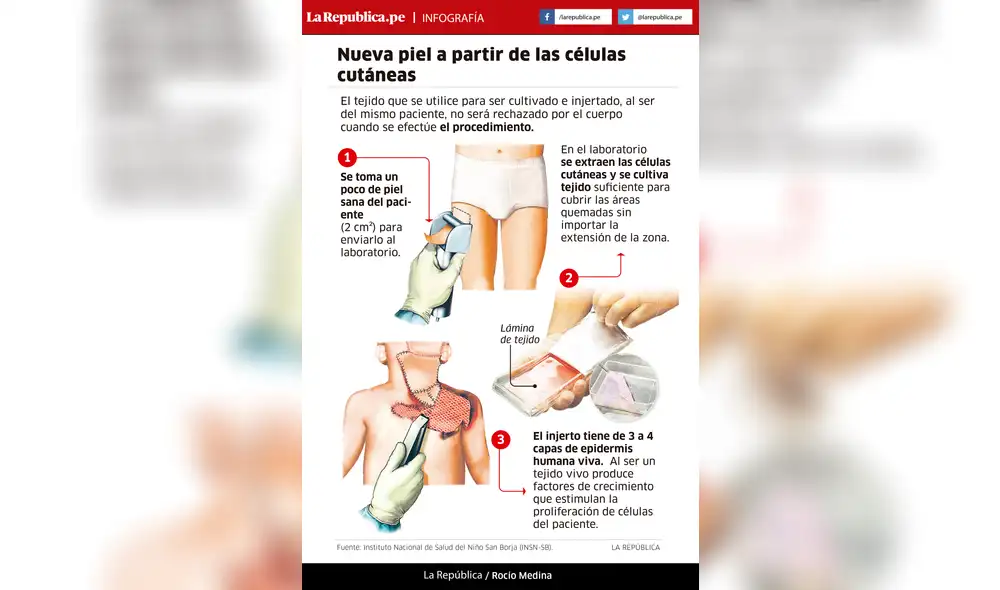 Nueva piel a partir de células cutáneas