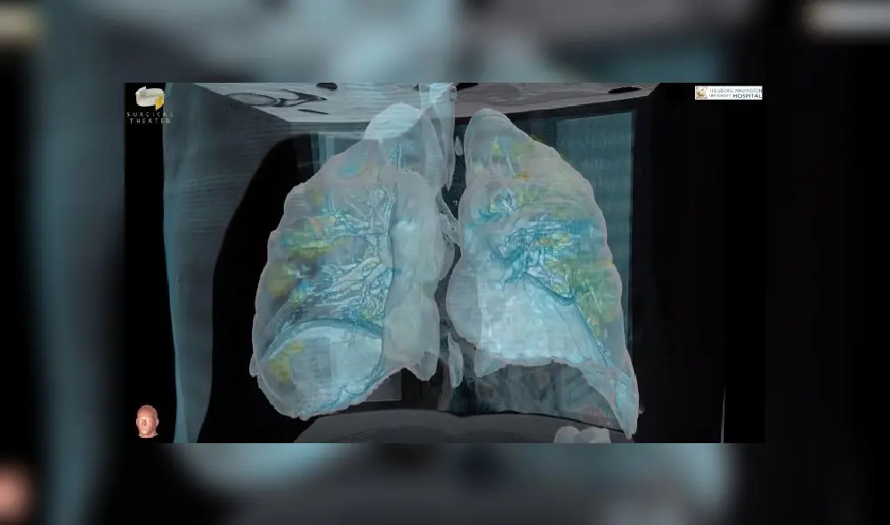 Coronavirus y pulmones Coronavirus y pulmones