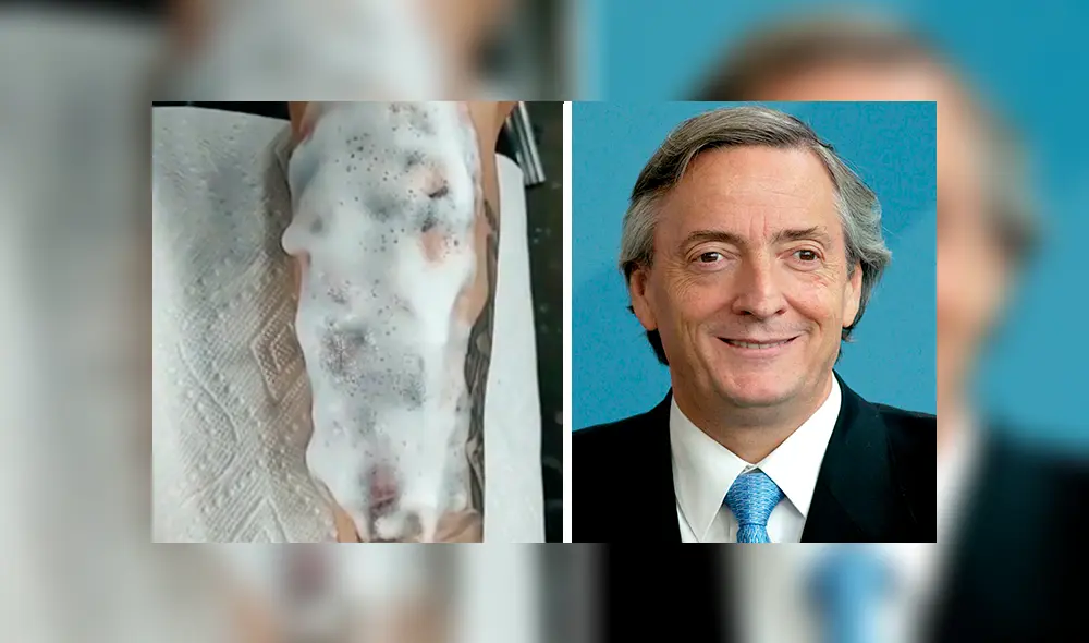 En Facebook, una mujer fanática del expresidente Néstor Kirchner se tatuó su rostro en todo el brazo. En Facebook, una mujer fanática del expresidente Néstor Kirchner se tatuó su rostro en todo el brazo.