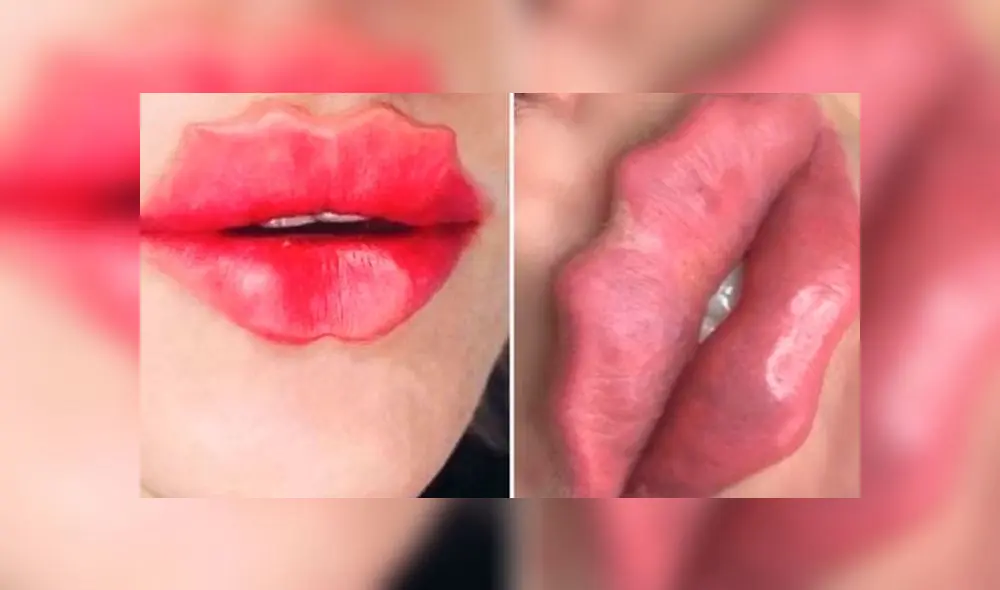 'Labios del diablo’: la polémica y peligrosa moda que causa furor en redes sociales [VIDEO]