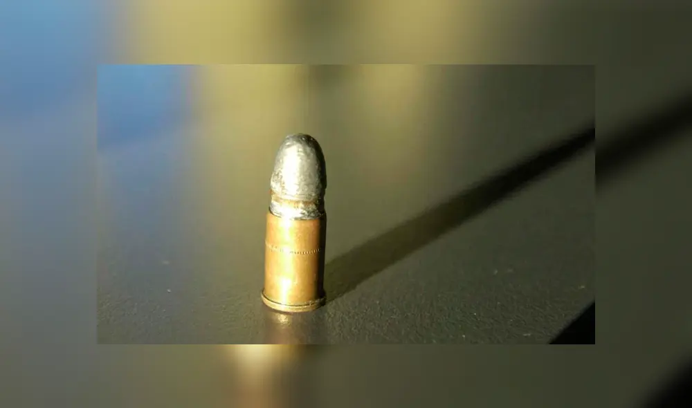 El hombre fue llevado a un hospital, donde se le realizó una placa radiográfica. Fuente: foto referencial.