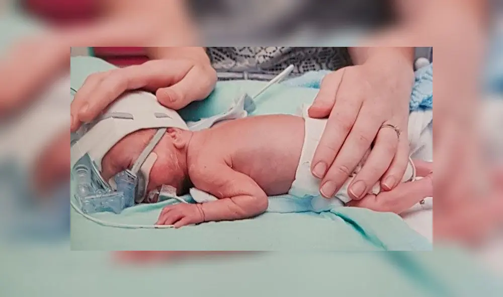 Nació con 500 gr de peso y llega a su primer año de vida contra todo pronóstico [FOTOS]
