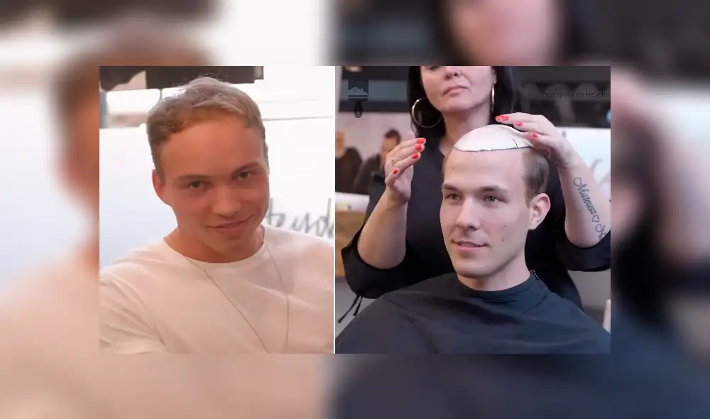 Desliza hacia la izquierda para ver el radical cambio de look de un hombre calvo. Desliza hacia la izquierda para ver el radical cambio de look de un hombre calvo.
