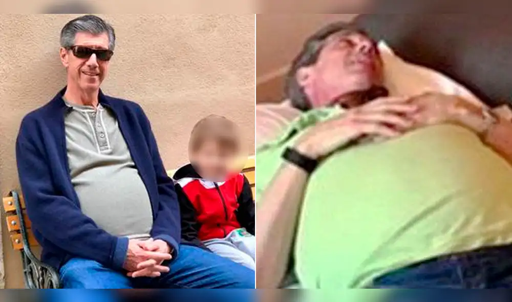 EE.UU.: pensó que estaba gordo, pero lo que encontraron en su interior pudo matarlo [FOTOS]