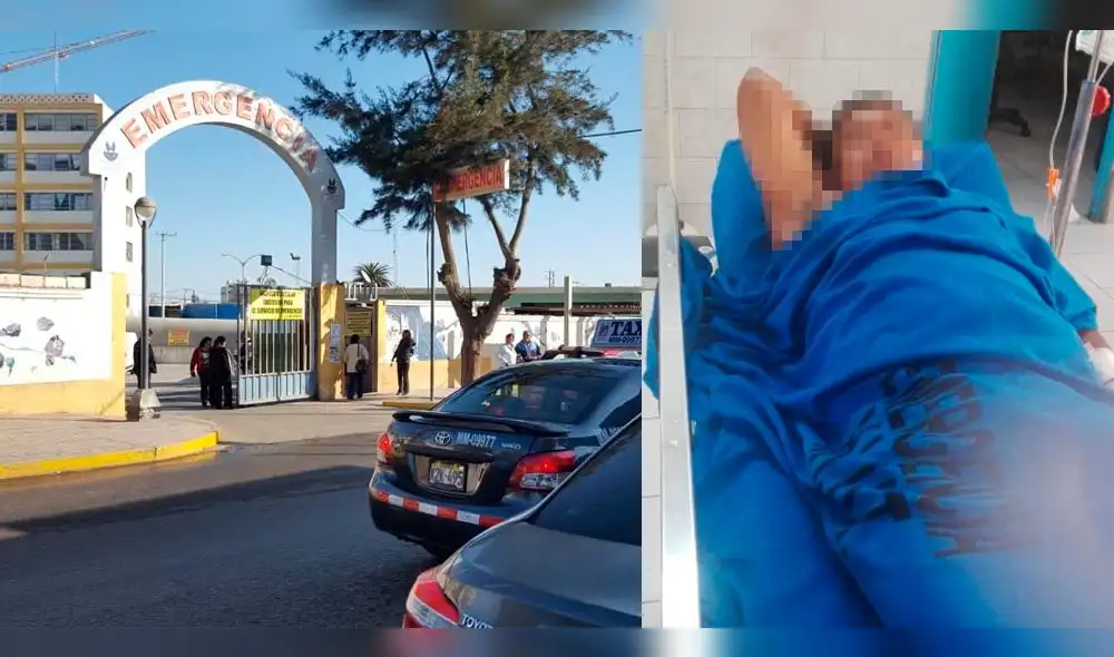 Tacna: mujer provoca cortes en miembro viril de su expareja tras doparlo