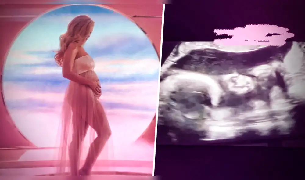 Katy Perry comparte el ultrasonido de su bebé en Instagram