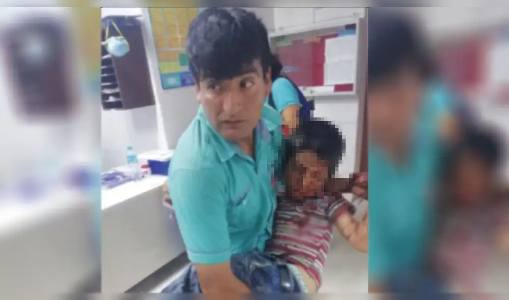 Amazonas: Niño perdió tres dedos tras manipular explosivo Amazonas: Niño perdió tres dedos tras manipular explosivo