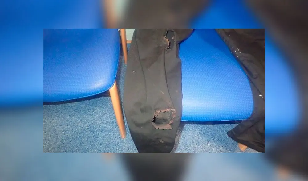 La grave quemadura que sufrió un hombre al guardar su cigarro electrónico en su bolsillo [FOTOS]