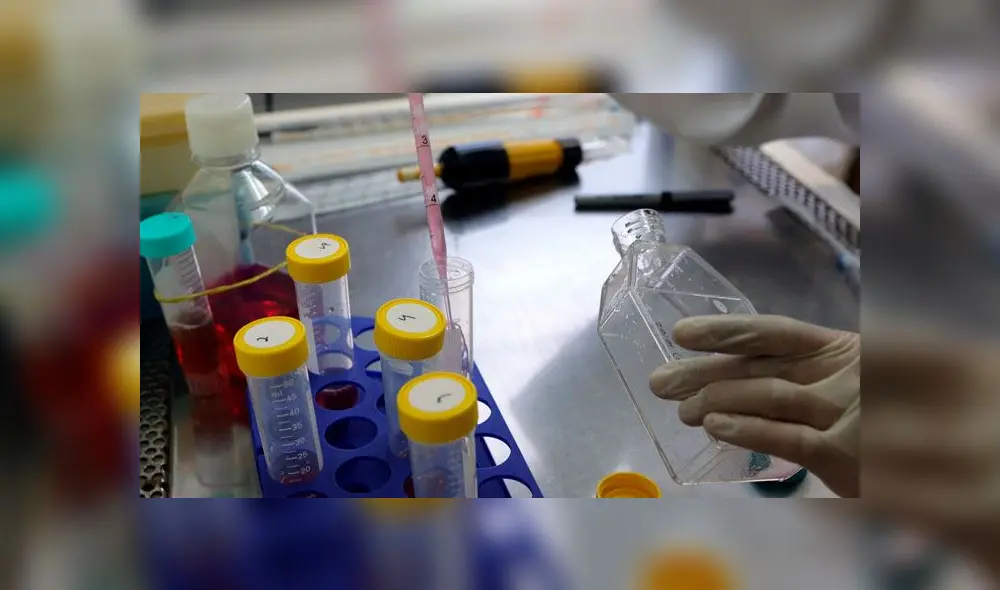 Examen determina que mujer de 61 años orina alcohol pese a no consumirlo Examen determina que mujer de 61 años orina alcohol pese a no consumirlo