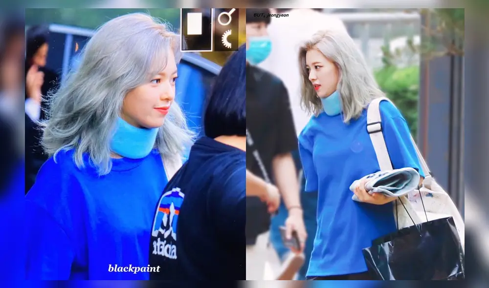 Jeongyeon de TWICE sufrió lesión