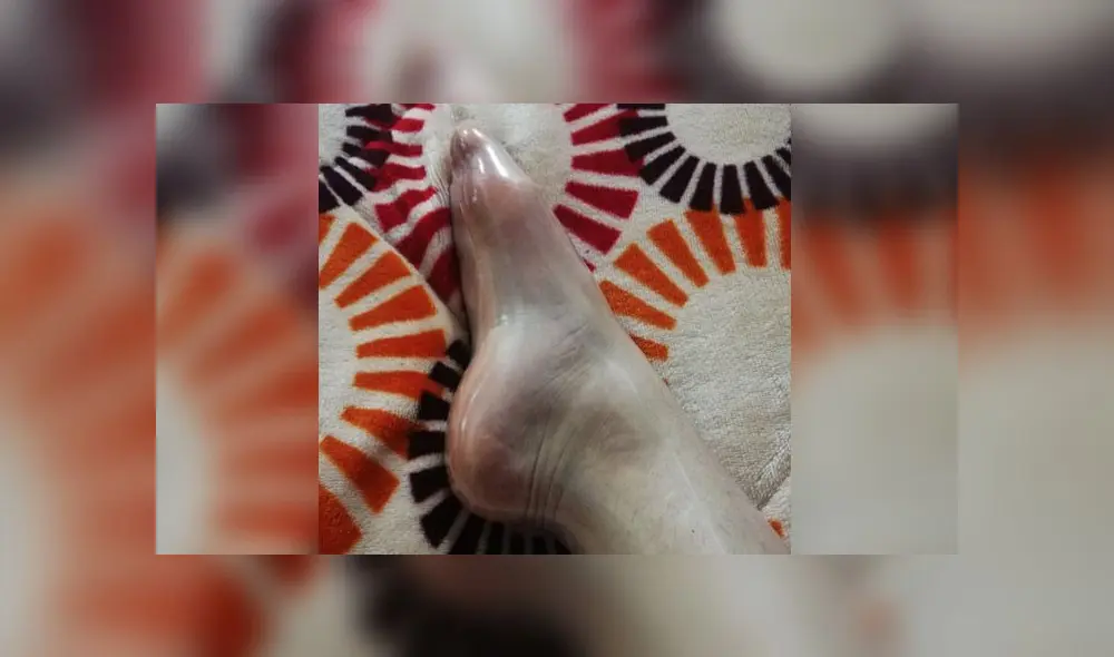 Joven se puso un condón en el pie y lo compartió en sus redes sociales. (Foto: Twitter (@valespinolaa)