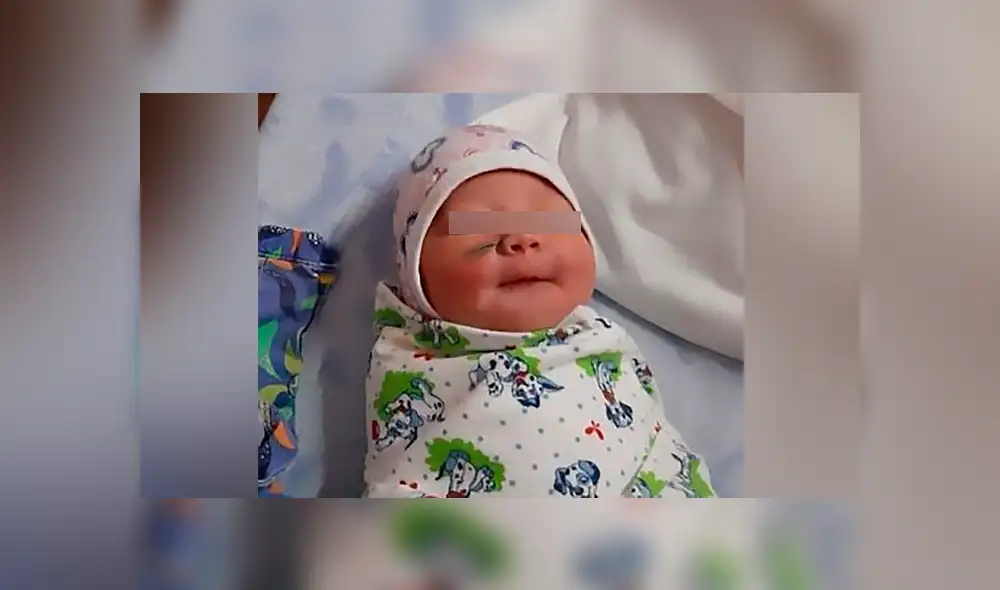 Bebé queda desfigurado tras ser cortado por los médicos durante cesárea [FOTOS] 