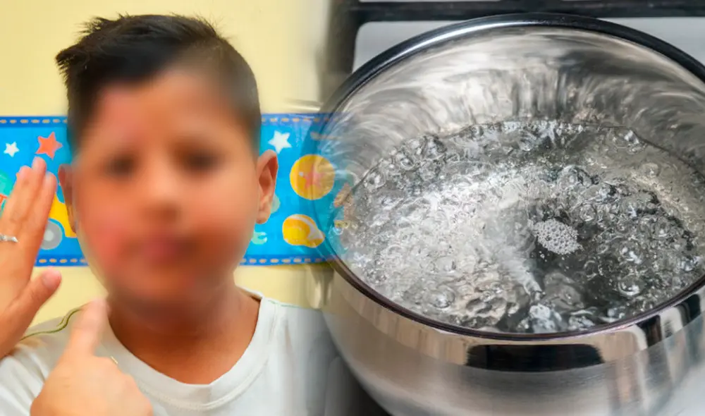 Aniquem: 90% de quemaduras en niños suceden dentro del hogar y en presencia de un adulto. Foto: composición Fabrizio Oviedo/LR/Aniquem/IiStock