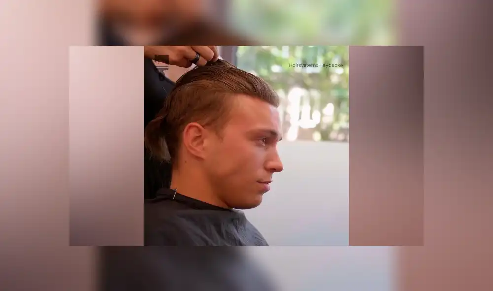 Desliza hacia la izquierda para ver el radical cambio de look de un hombre calvo. Desliza hacia la izquierda para ver el radical cambio de look de un hombre calvo.