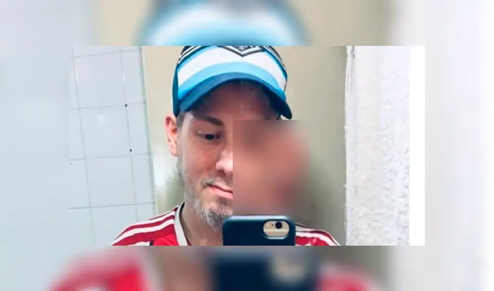 Joven que padece cáncer en la cara consiguió ayuda de un médico tras difundir un video en las redes sociales. Foto: Instagram Joven que padece cáncer en la cara consiguió ayuda de un médico tras difundir un video en las redes sociales. Foto: Instagram