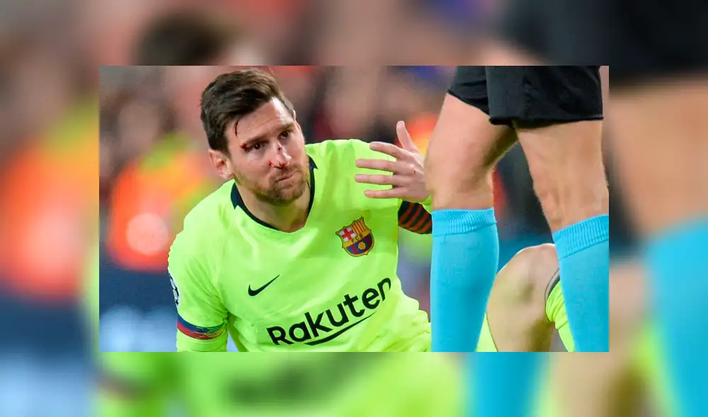 Barcelona vs Manchester United: Messi sufrió espeluznante corte tras duro choque