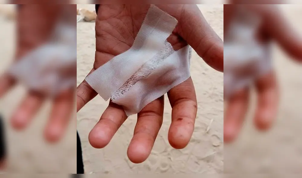 Víctima logró desviar dirección de la bala con su mano.