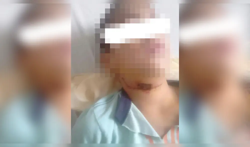 Menor casi muere decapitado en Tumbes.