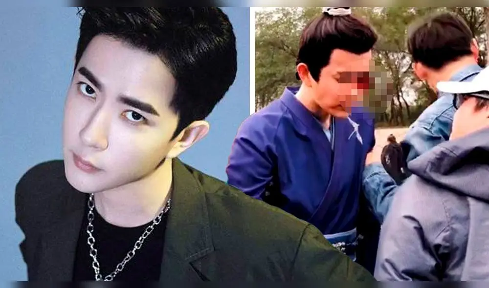 Alan Yu resultó herido en el ojo izquierdo mientras grababa una escena de acción con espadas.