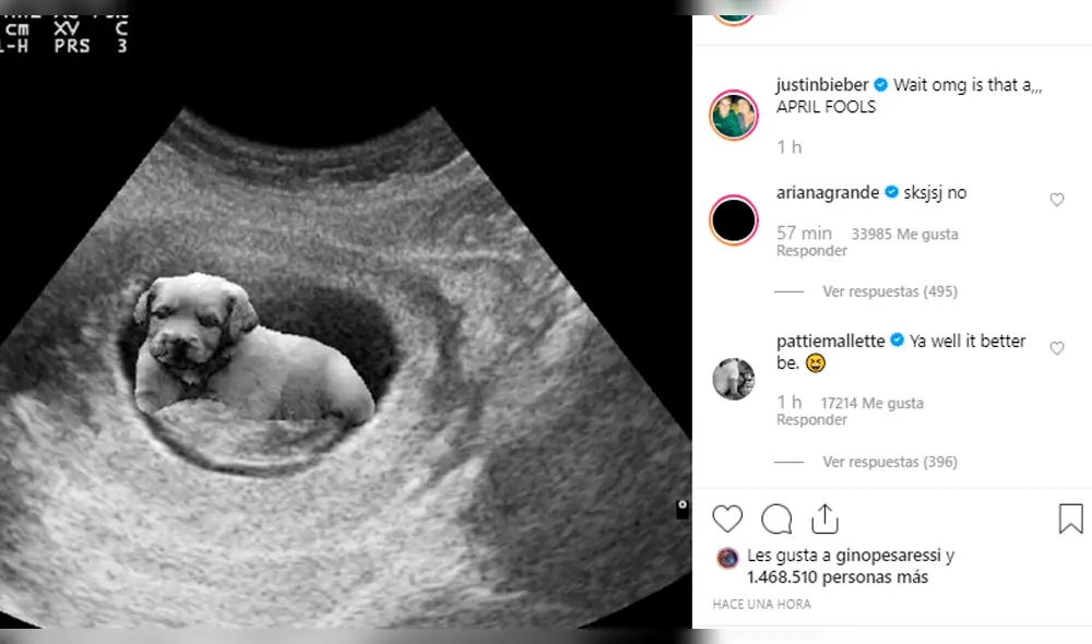 ¿Justin Bieber y Hailey Baldwin serán padres? Ecografía alborotó las redes