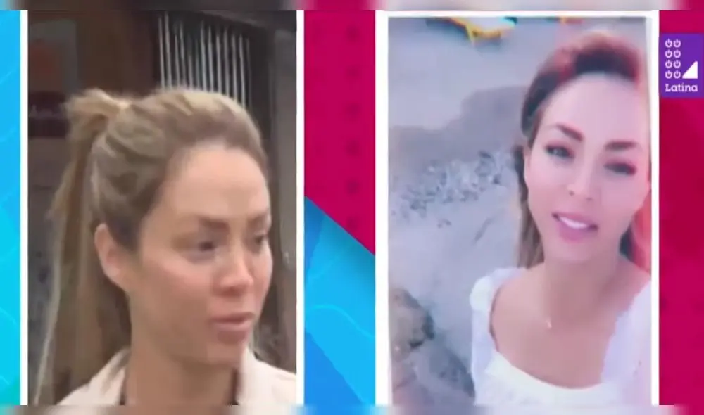 Sheyla Rojas sufre transformación en su rostro tras viaje con millonario Sheyla Rojas sufre transformación en su rostro tras viaje con millonario