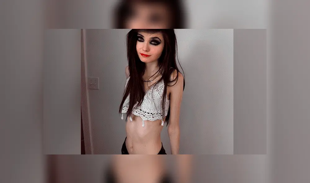 YouTube viral: Chica youtuber tiene radical cambio tras estar a punto de morir de anorexia [VIDEO]