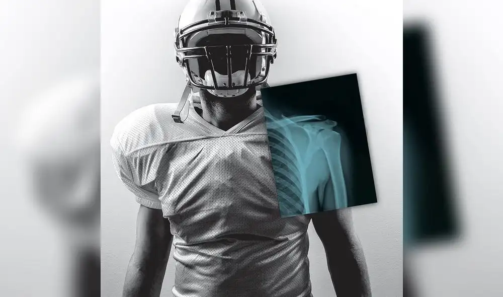 Conoce la tecnologia que ahora aportará a la medicina deportiva