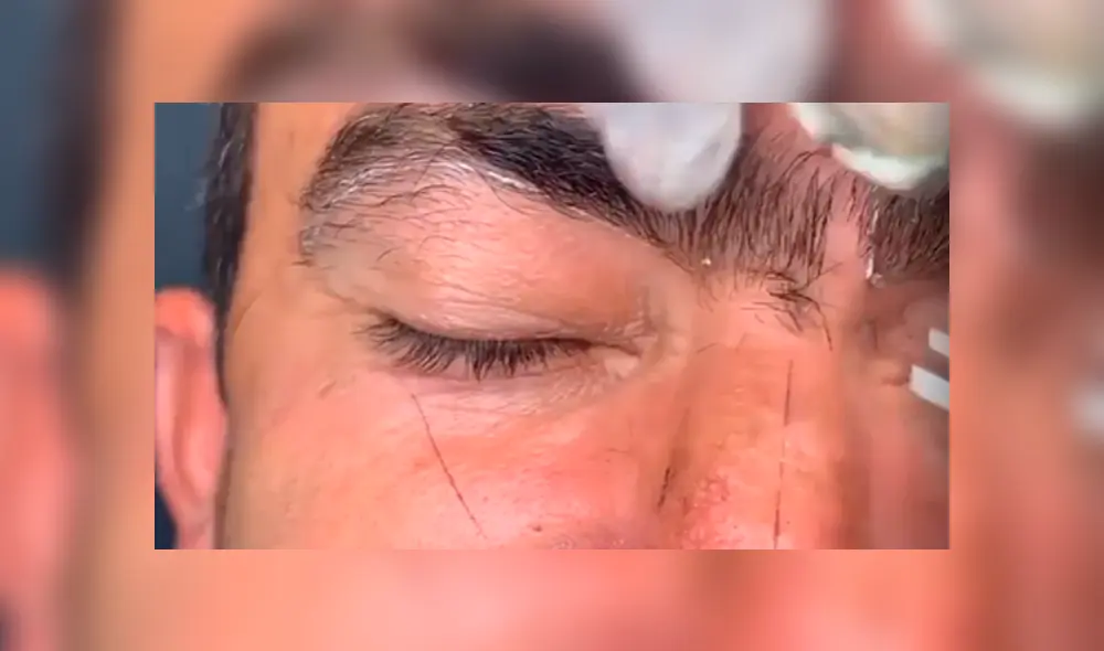 Facebook viral: hombre con las cejas ‘pobladas’ se somete a drástico cambio de ‘look’ y resultado cautiva a miles