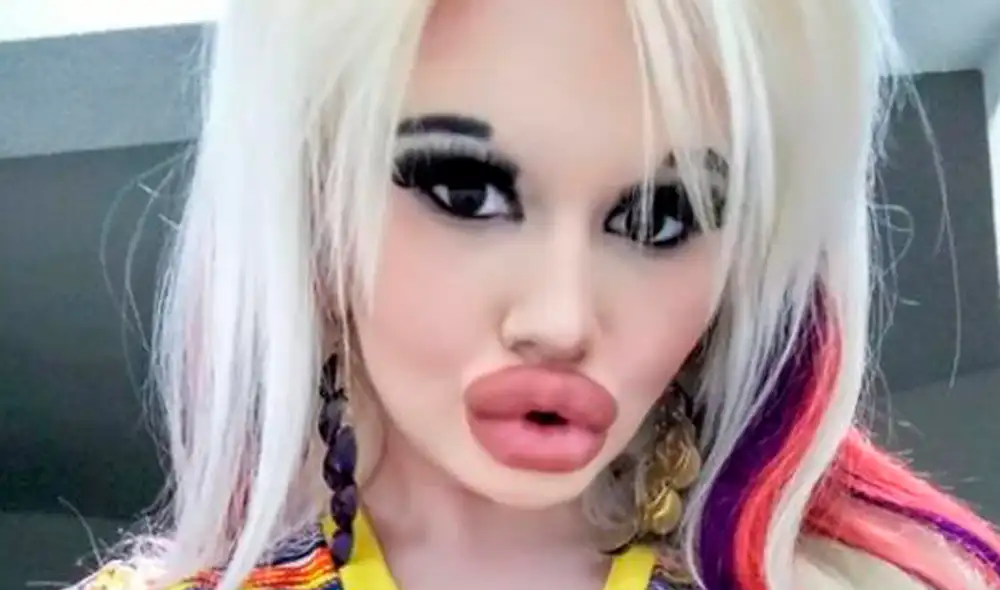 Adolescente quiso ser como ‘Barbie’, pero terminó pareciéndose a una muñeca inflable