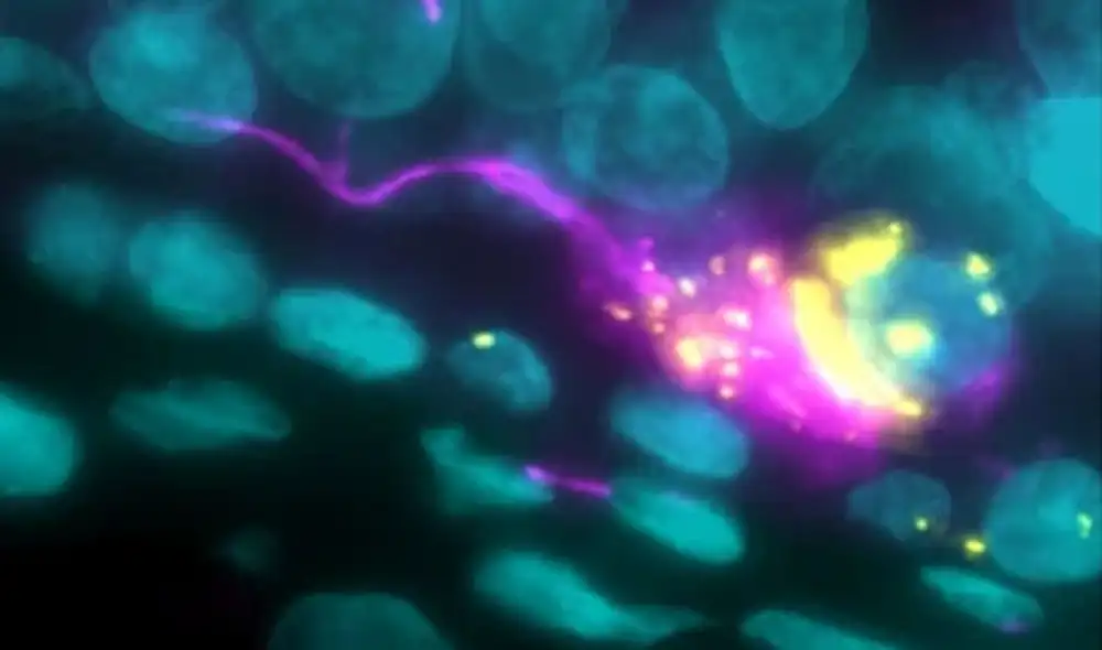 Proteínas S del coronavirus dentro de filamentos neuronales. Foto: Heppner et al