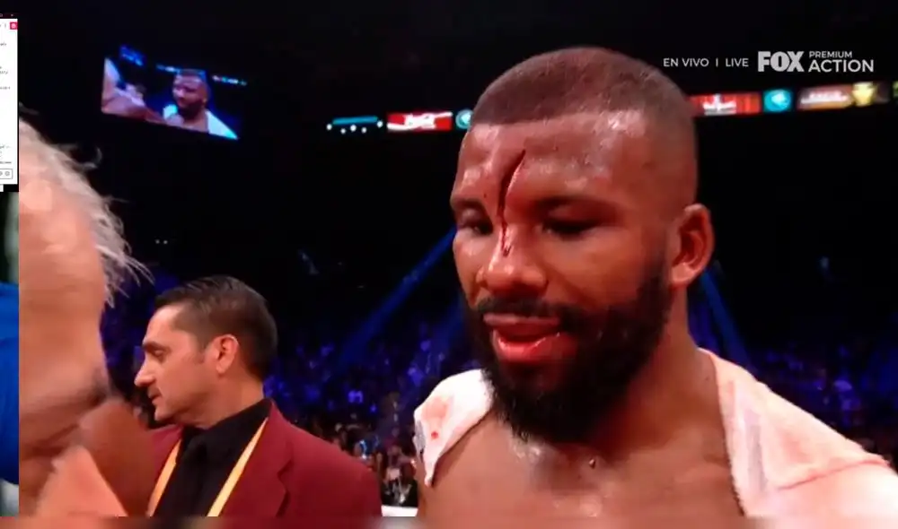 Pacquiao vs Broner: El espeluznante corte en la frente de Badou Jack [FOTO]