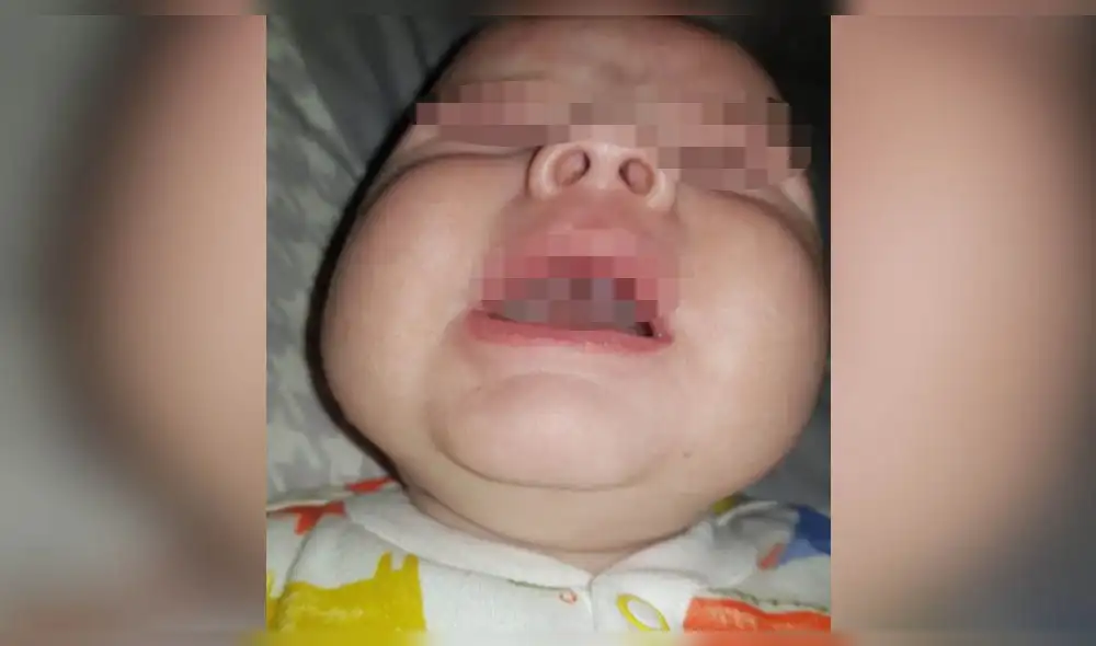 Insólito: a un bebé le creció un ‘colmillo’ durante la noche [FOTO]