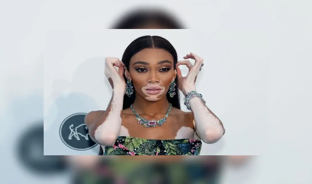 Maluma y Winnie Harlow: modelo publicó una foto junto al cantante colombiano donde se les ve cariñosos Maluma y Winnie Harlow: modelo publicó una foto junto al cantante colombiano donde se les ve cariñosos