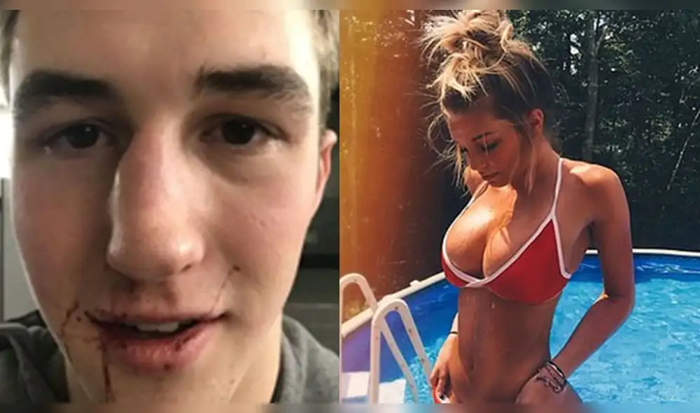 Exculpan a modelo que rompió de un puñete la nariz a su novio porque él terminó relación