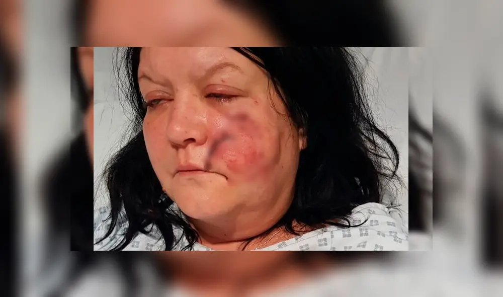 Niño apuñala a perro siberiano para evitar que el animal asesine a su niñera [FOTOS]