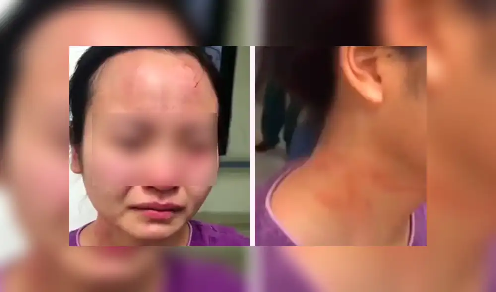 Paciente con coronavirus golpeó a una enfermera y le mordió en la cara para escapar de la cuarentena. (Foto: Captura) Paciente con coronavirus golpeó a una enfermera y le mordió en la cara para escapar de la cuarentena. (Foto: Captura)