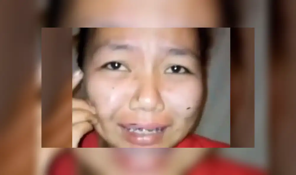 Facebook: muchacha asiática deseaba lucir como estrella K-Pop y se termina 'desfigurando' el rostro