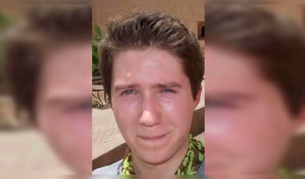 Fan de BTS se somete a costosa cirugías para ser similar a Jimin [FOTOS]