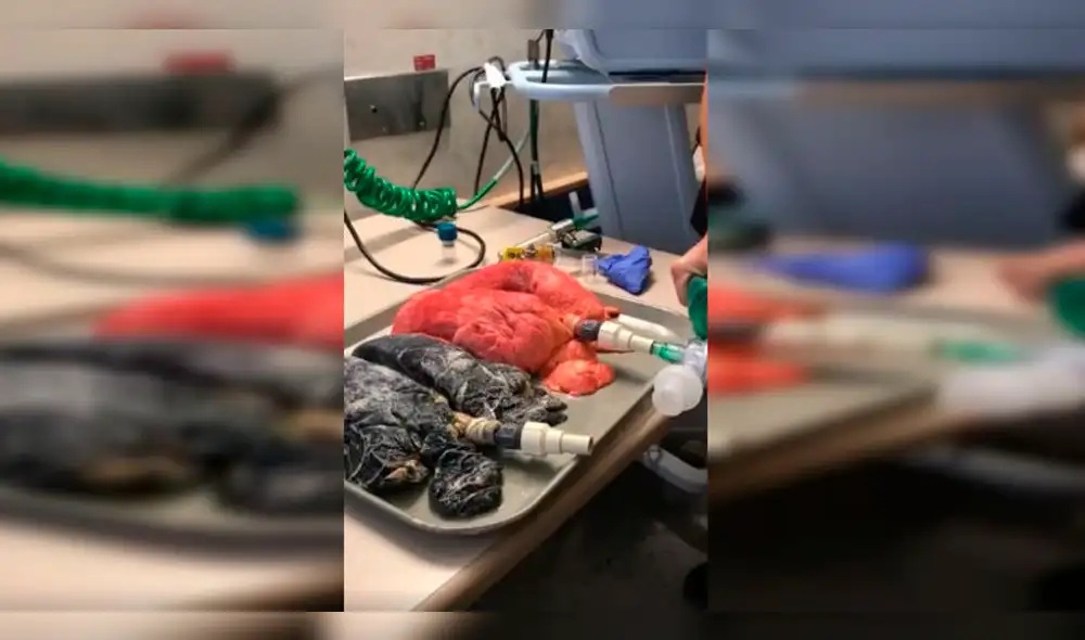 Vídeo viral de los pulmones sanos vs los de un fumador impacta en YouTube