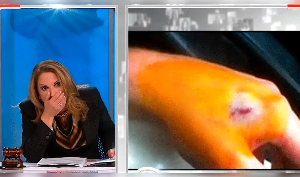 Ana María Polo furiosa con litigante por poner raro objeto en el cuerpo de su hija 