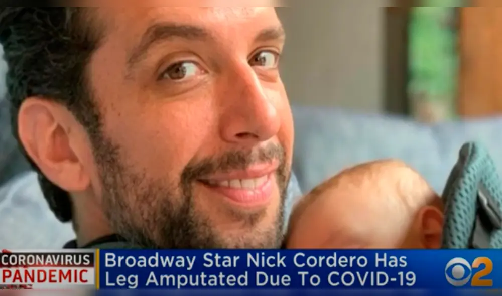 Nick Cordero, actor de Brodway, sufre la amputación de una pierna por el coronavirus Nick Cordero, actor de Brodway, sufre la amputación de una pierna por el coronavirus