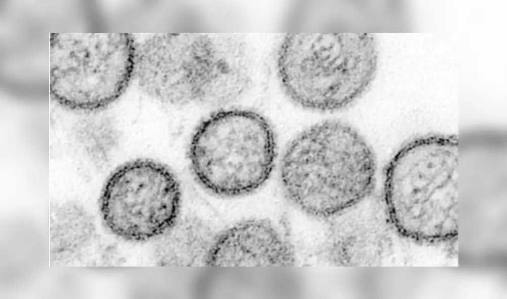 Se confirmó la primera muerte por fiebre hemorrágica en Brasil, después de más de 20 años. El paciente era portador del arenavirus. (Foto: Internet) Se confirmó la primera muerte por fiebre hemorrágica en Brasil, después de más de 20 años. El paciente era portador del arenavirus. (Foto: Internet)